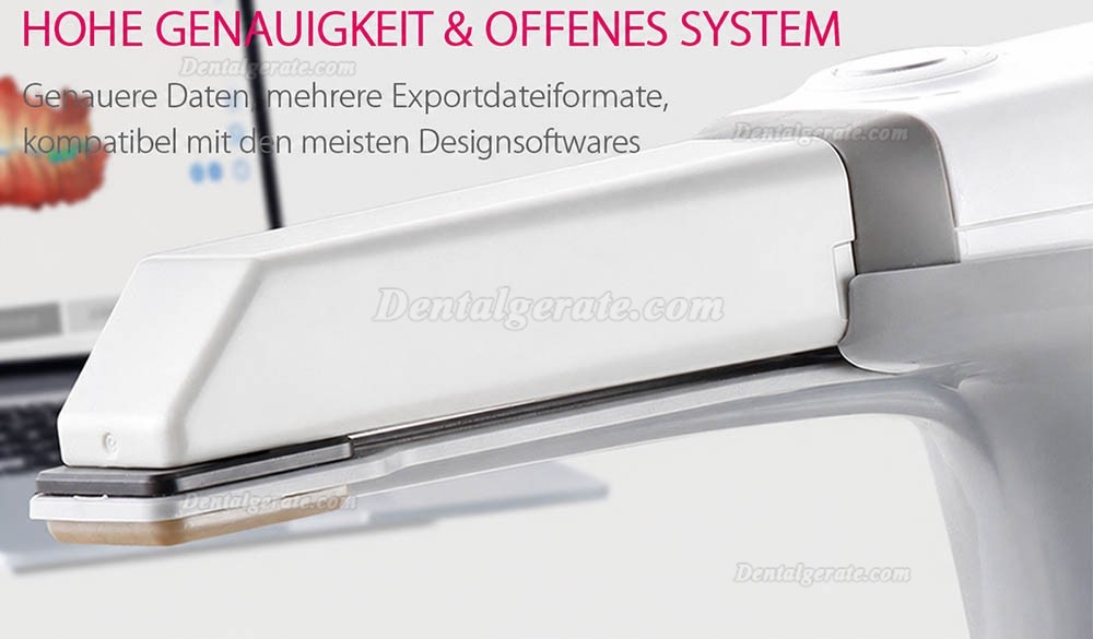 Runyes 3DS Dental 3D Digitaler Intraoralscanner Pulverloses Echtfarbscannen Runyes 3DS Dental 3D Digitaler Intraoralscanner Pulverloses Echtfarbscannen